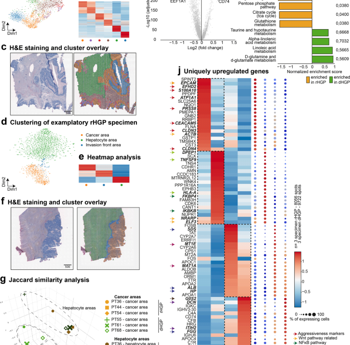 High-impact paper with single cell and spatial data